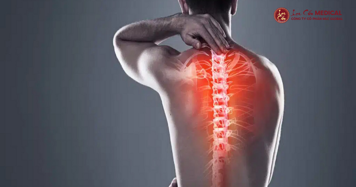 Dấu hiệu nhận biết cảnh báo cột sống đang _quá tải