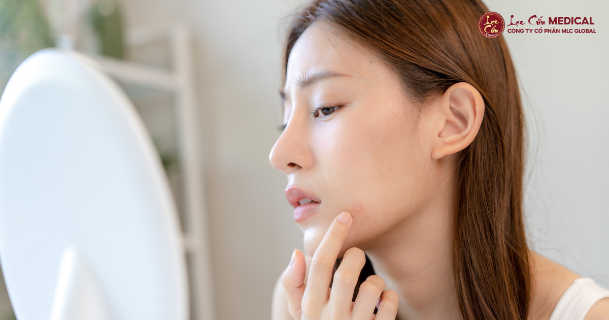 Bí Tắc_ Làn Da_ Có Phải Chỉ Là Do Tuổi Tác Hay Mỹ Phẩm