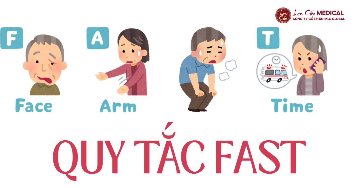 Nhận Biết Sớm Bằng Quy Tắc FAST – Nắm Giữ “Cơ Hội Vàng”