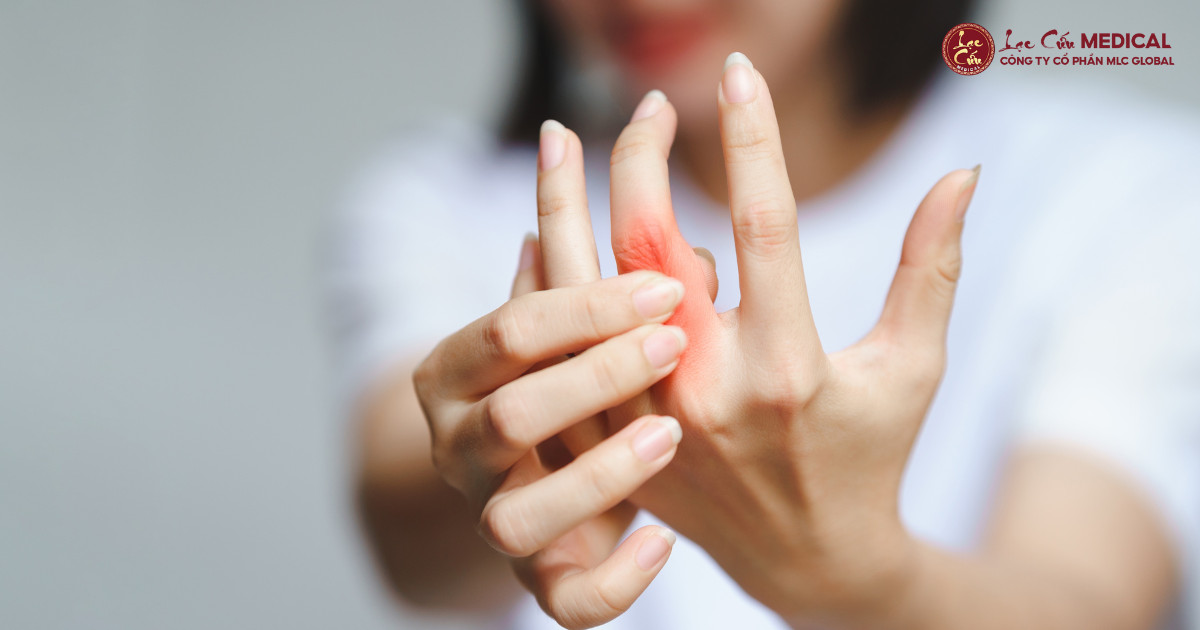 Tách_ Một Cái Đau Nhói_ Hiểu Rõ Về Bệnh Ngón Tay Cò Súng
