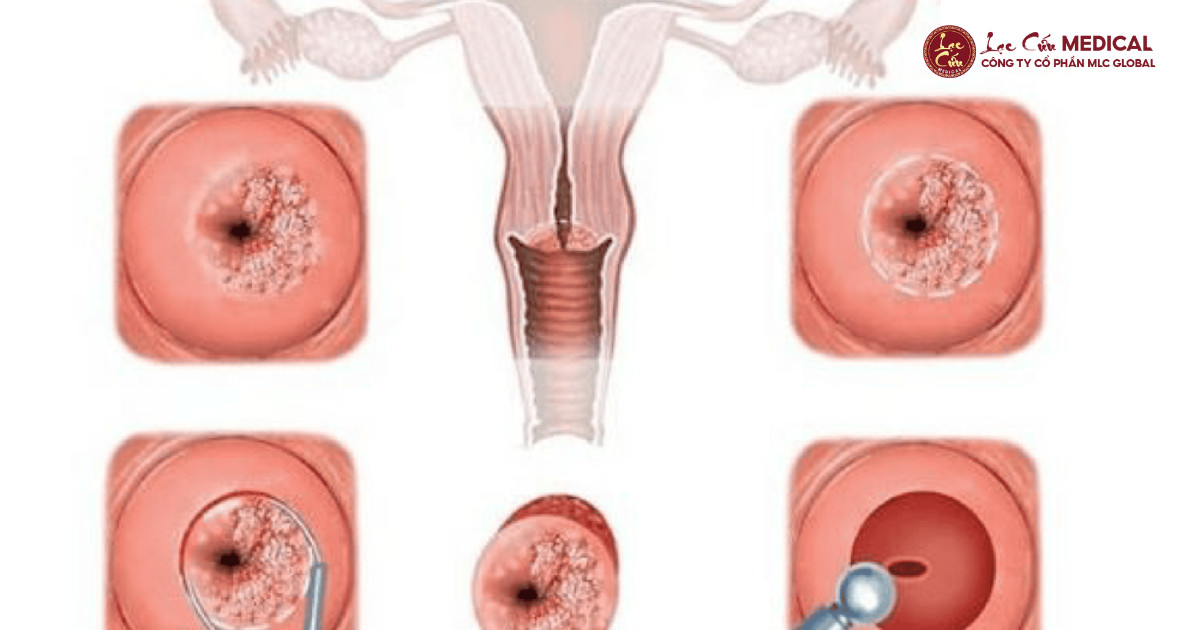 “Tử Cung Chứa Đầy Rác”_ Khi Nỗi Lo Chỉ Là Bề Nổi