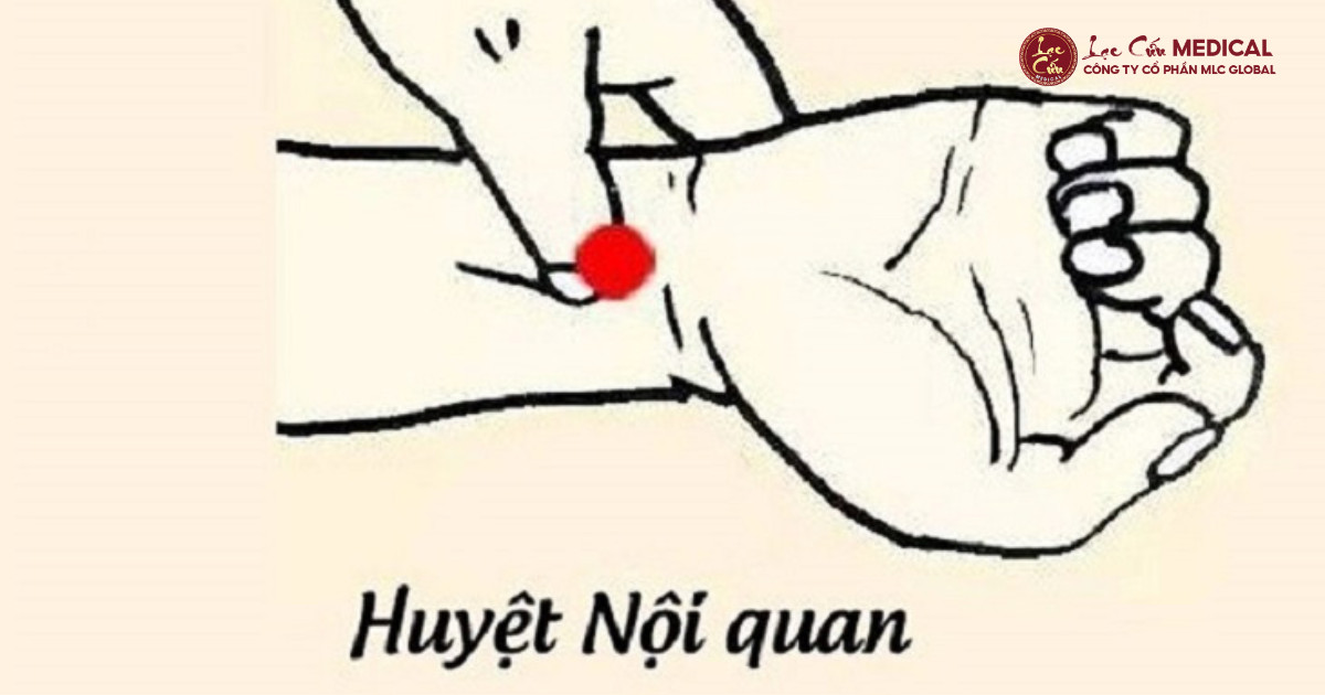 Huyệt Nội Quan_ _Chìa Khóa An Thần_ Từ Y Học Cổ Truyền