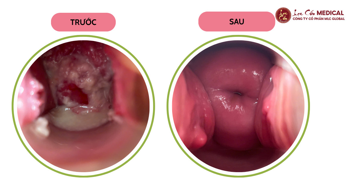 Kết Quả Hơn Cả Trị Liệu_ Viên Mãn Trong Đời Sống Vợ Chồng