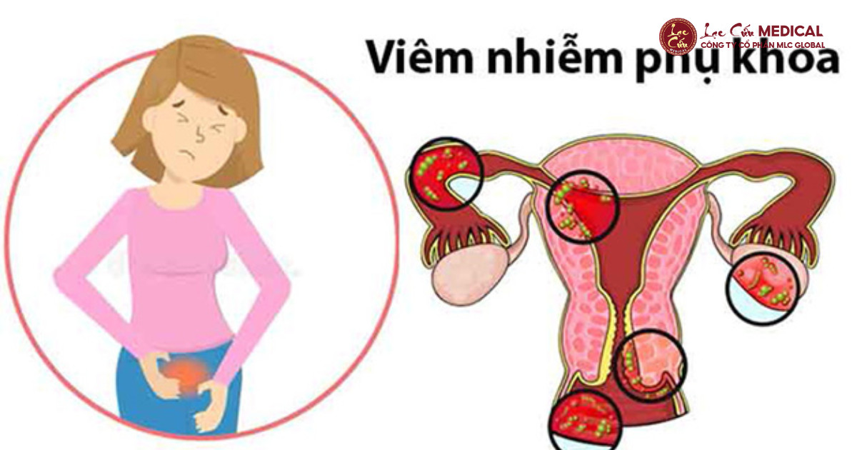 Thực Trạng Đáng Báo Động_ Ngứa Rát Không Phải Là Viêm Nhẹ!