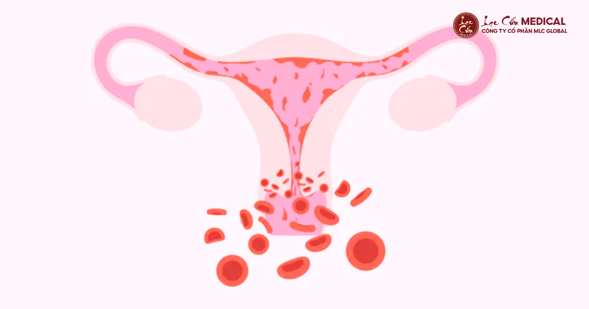 Tử Cung_ Trung Tâm Điều Hòa Năng Lượng và Nhan Sắc