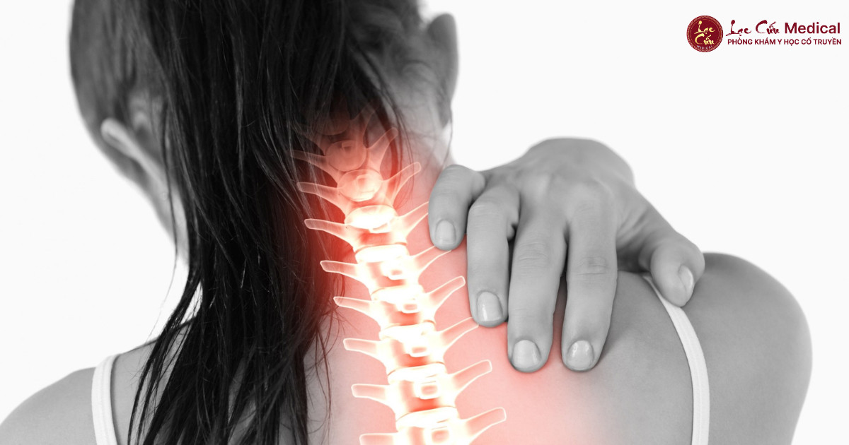 Cơ Thần Kinh Quá Tải_ Khi Vai Gáy Trở Thành “Điểm Đen” Của Mọi Nghề Nghiệp