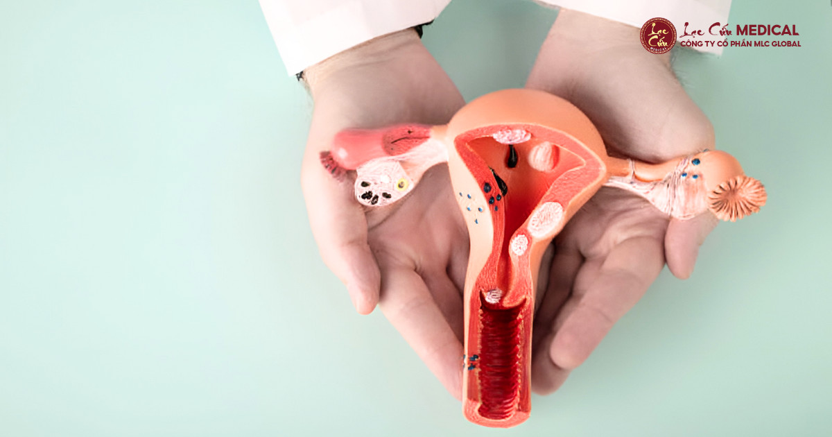 Tử Cung_ Gốc Rễ Của Sắc Đẹp và Sức Khỏe Nữ Giới