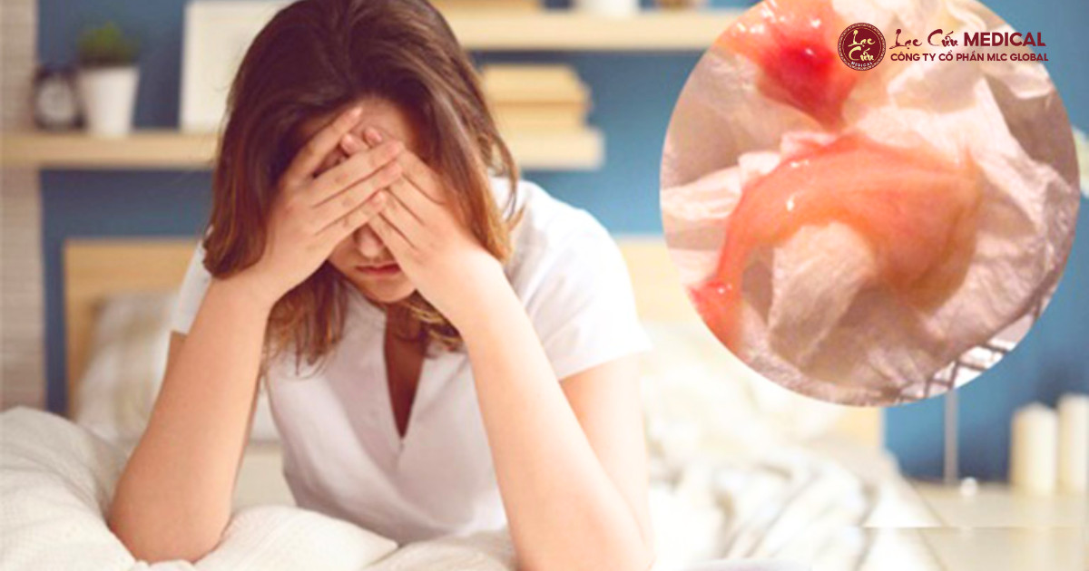 Viêm Tái Phát_ Lời Cảnh Báo Về Nền Tảng Sức Khỏe Phụ Khoa