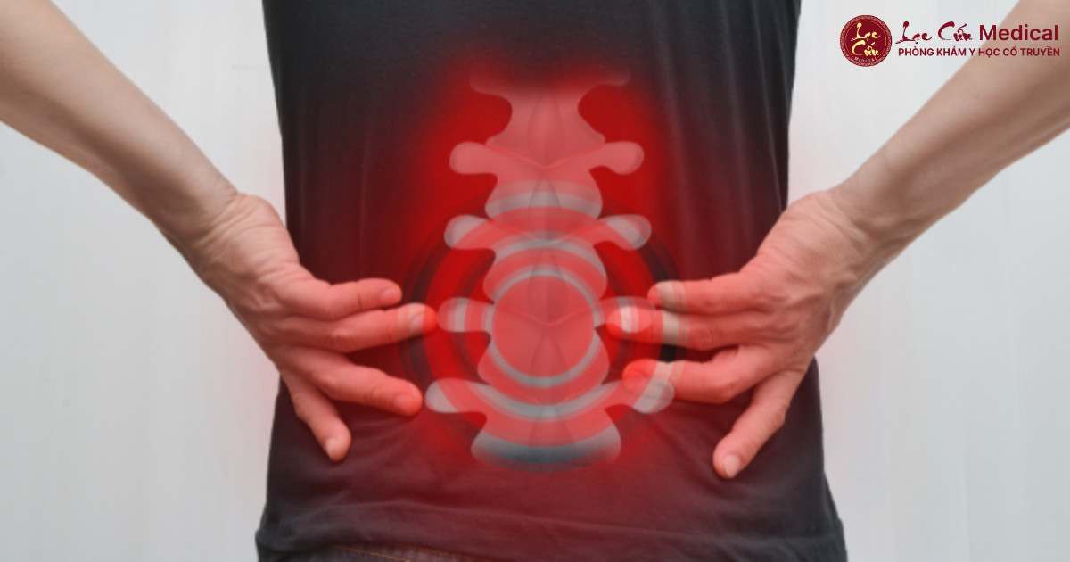 Cột Sống Sai Trục – Nỗi Ám Ảnh Chung Của Người Hiện Đại