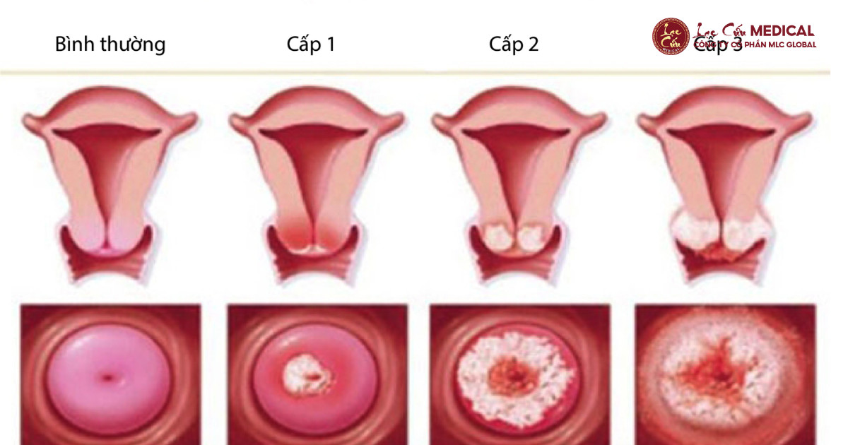 Những Thói Quen Tưởng Bình Thường Lại Âm Thầm Gây Hại
