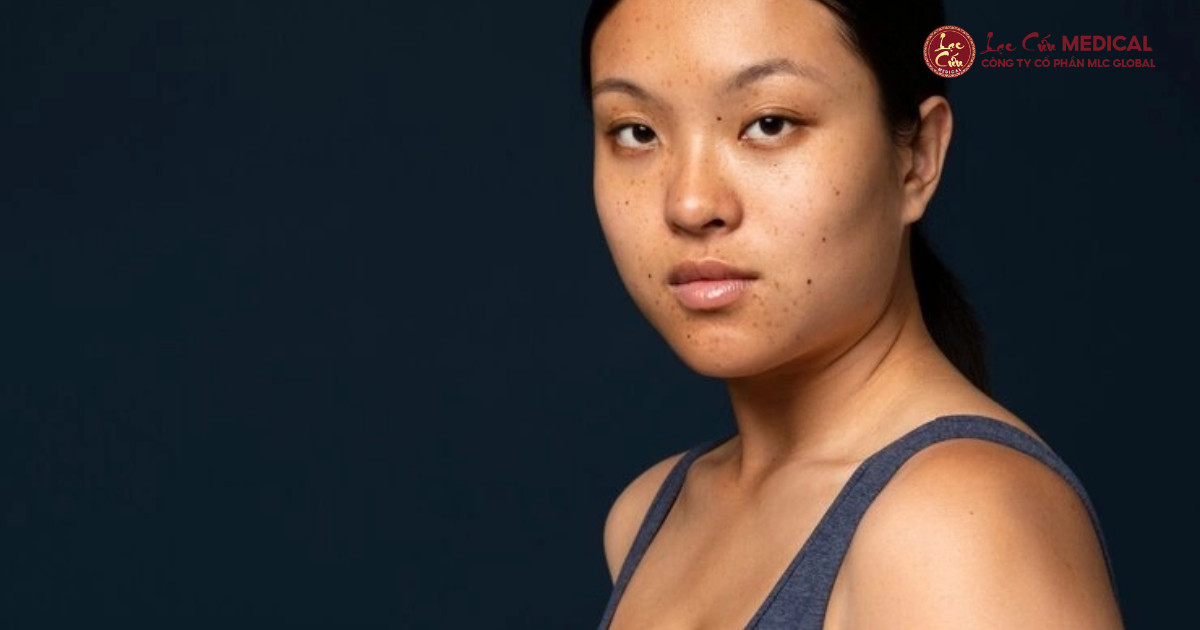 Thực Trạng Báo Động – Sự Thật Phũ Phàng Sau Sinh Và Tuổi 30