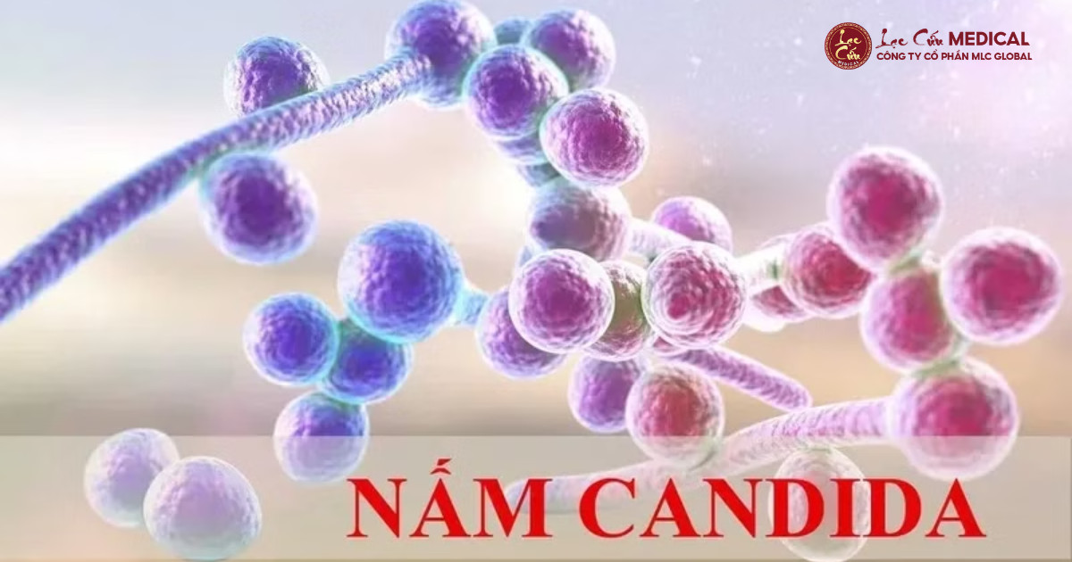 Viêm Nấm Candida_ Khi _Hàng Rào Bảo Vệ_ Tự Nhiên Suy Yếu