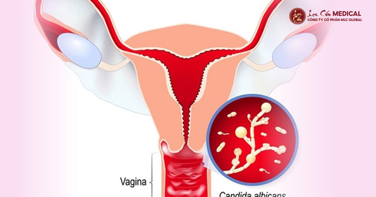 Vòng Lặp Tái Phát_ Sai Lầm Khi Chỉ Trị Triệu Chứng