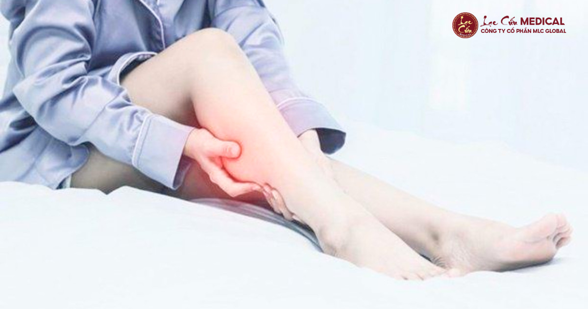 10 Dấu Hiệu Cảnh Báo Sớm Giai Đoạn _Tiền_ Suy Giãn Tĩnh Mạch