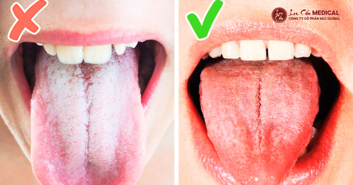 Giải Mã Tín Hiệu _Tỳ Khí Yếu_ Qua Lăng Kính Đông Y