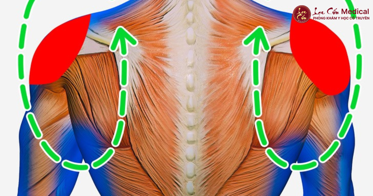 Góc Nhìn Đông Y_ Khi Khí Huyết Ứ Trệ Tại Các Bó Cơ