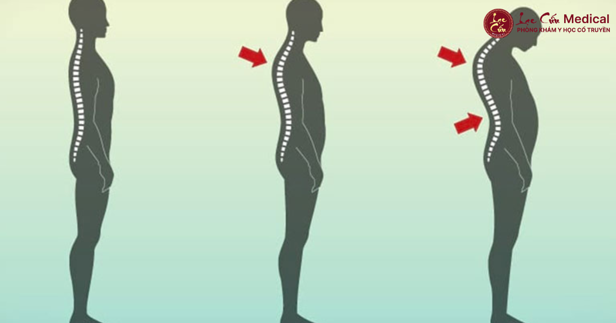 Hệ Quả Âm Thầm Nhưng _Tàn Phá_ Thể Trạng