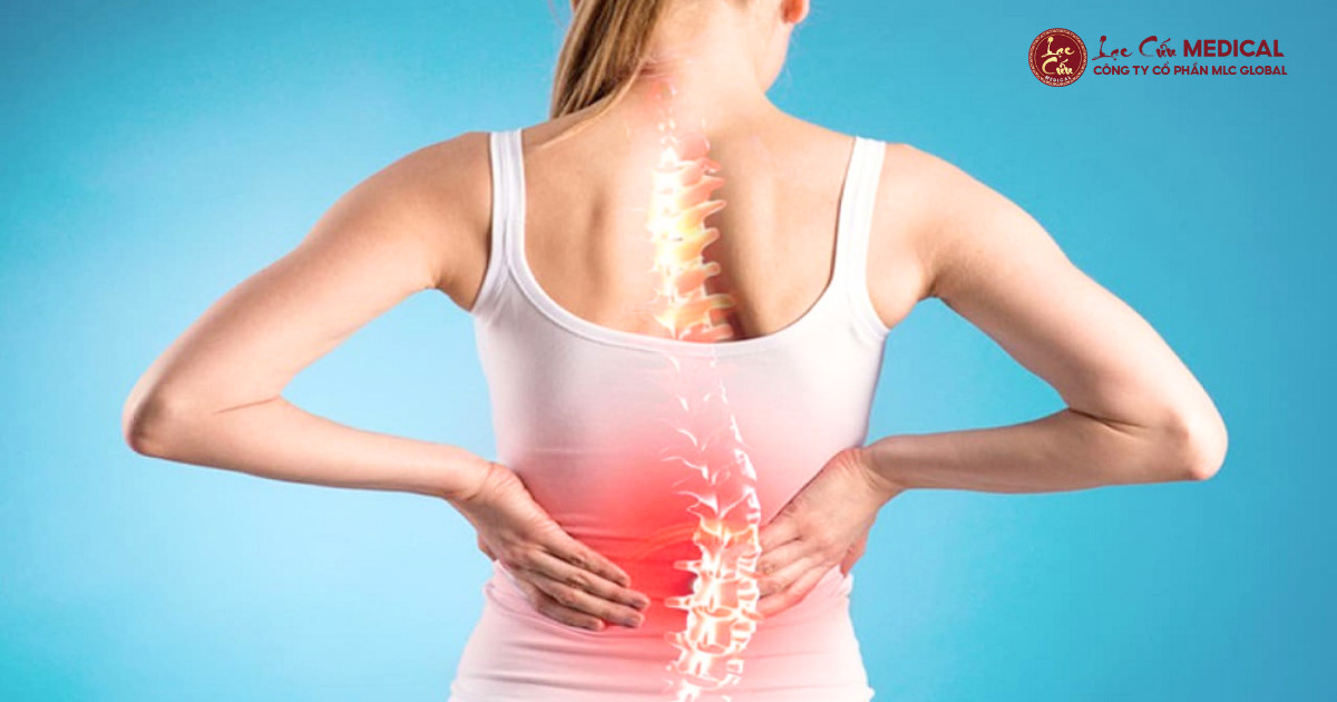 Khi Áp Lực Cuối Năm Trở Thành _Gánh Nặng_ Cho Cột Sống