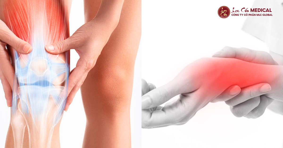 Khớp Vận Động Kém – Khi Cơ Thể Phải _Gánh Thay