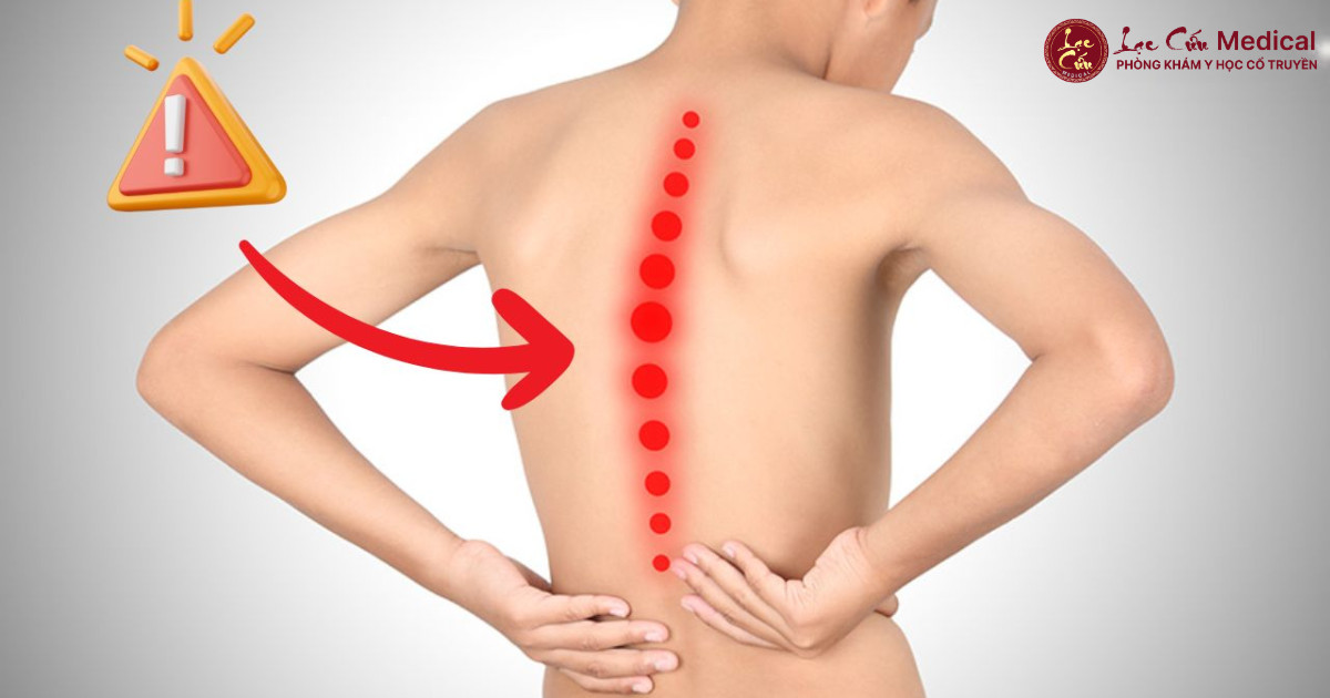 Tại Sao Tình Trạng Gù Lưng – Cổ Rùa Ngày Càng Phổ Biến