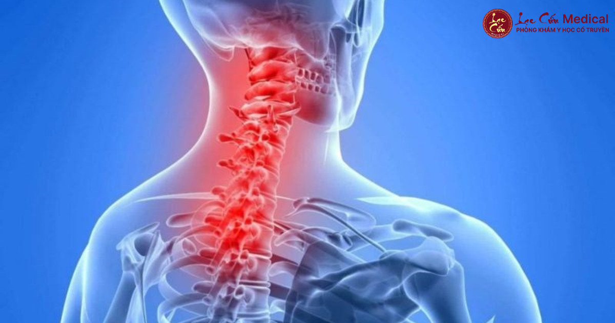 10 Dấu Hiệu Cảnh Báo Cổ Vai Gáy Đang _Kêu Cứu