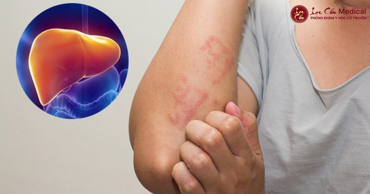 7 Dấu Hiệu SOS Cho Thấy Gan Bạn Đang Gặp Nguy Hiểm