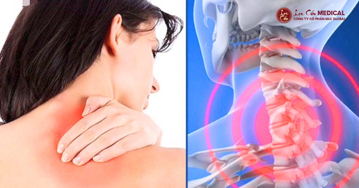 Cơn Đau Cổ Âm Ỉ_ Tín Hiệu SOS Bị Bỏ Quên Dịp Cuối Năm