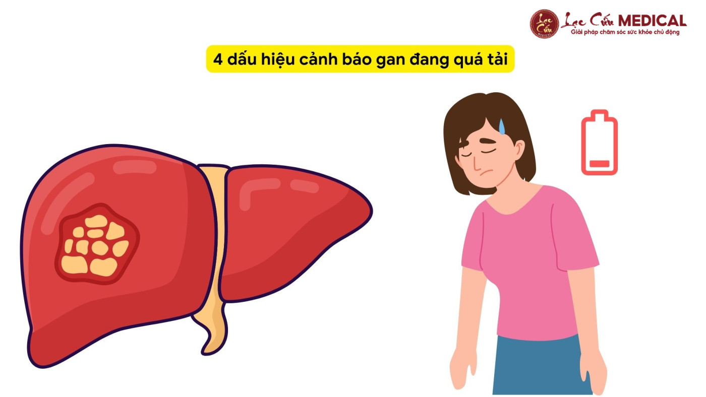 Dấu Hiệu Cho Thấy Gan Bạn Đang _Kêu Cứu_ Vì Quá Tải