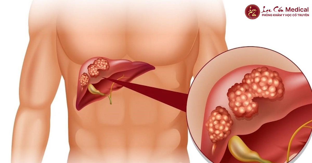 Khi _Nhà Máy Thải Độc_ Trở Nên Quá Tải