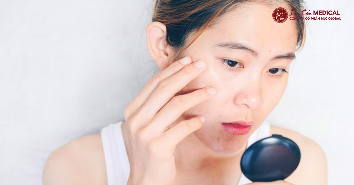 Tại Sao Cận Tết Da Lại _Xuống Cấp_ Nhanh Đến Thế