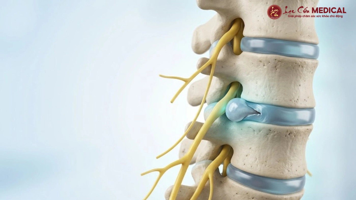 2. Nguyên Nhân Tê Bì Chân Tay Thường Gặp