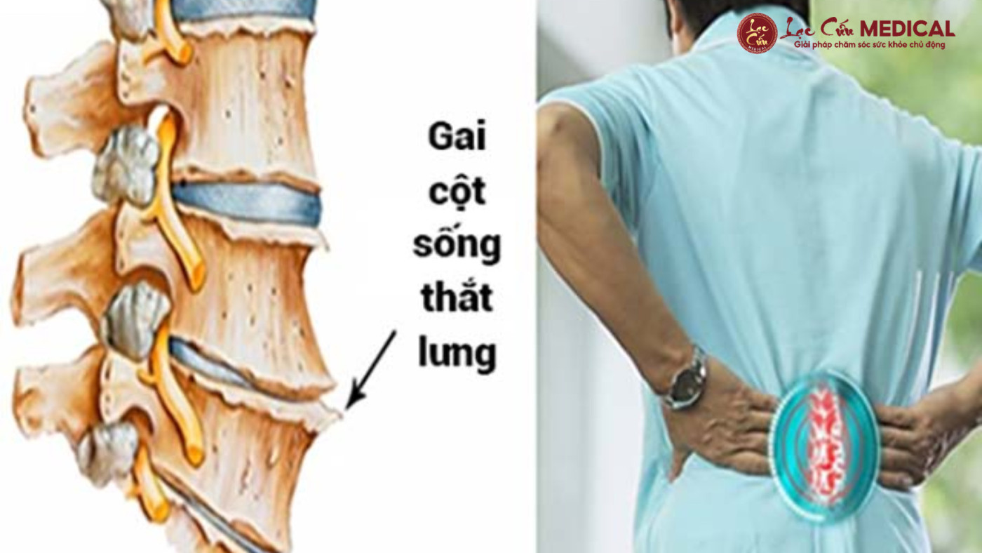 5 Biến Chứng _Âm Thầm_ Nhiều Người Đang Bỏ Qua