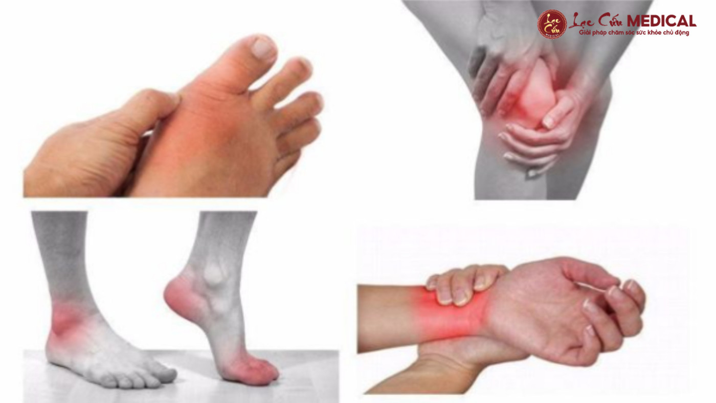 5 Nguyên Nhân Phổ Biến Khiến Người Lớn Tuổi Thường Xuyên Tê Bì