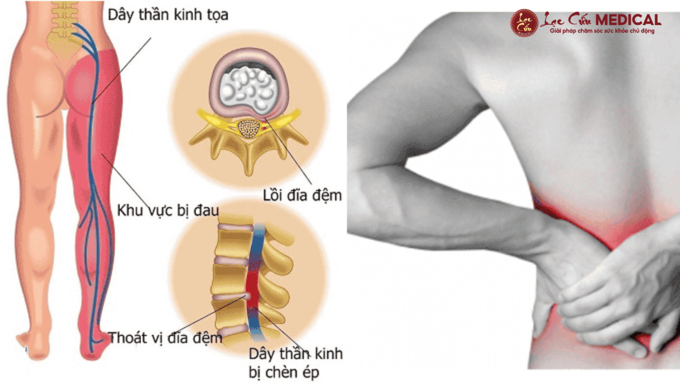 Cảnh Báo Nguy Hiểm Từ Cơn _Hết Đau Giả