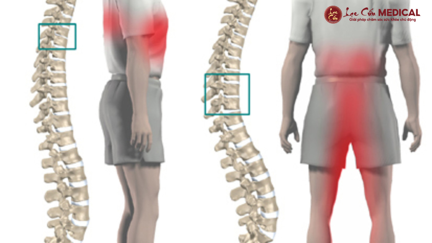 Dấu Hiệu Nhận Biết_ Đừng Để _Cái Gai_ Lớn Dần Theo Thời Gian