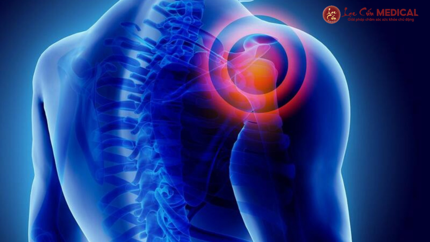 Dưới Góc Nhìn Đông Y_ Tại Sao Vai Lại Đau Và Tê