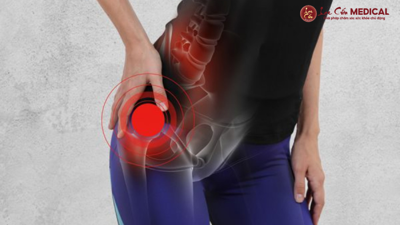 Nhận Diện Dấu Hiệu Thoái Hóa Khớp Hông_ Bạn Có Đang Ngó Lơ