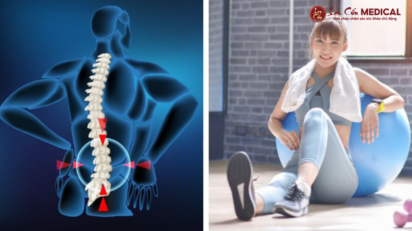 Nỗi Lo Thoát Vị Đĩa Đệm_ Tập Gym Là _Liều Thuốc_ Hay _Con Dao Hai Lưỡi