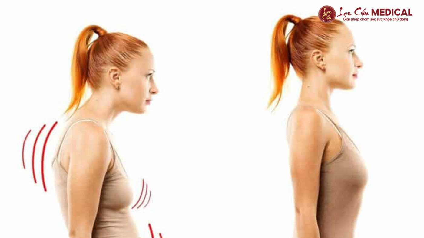 Cổ Rùa_ – Khi Thói Quen Nhỏ Để Lại Hậu Quả Lớn