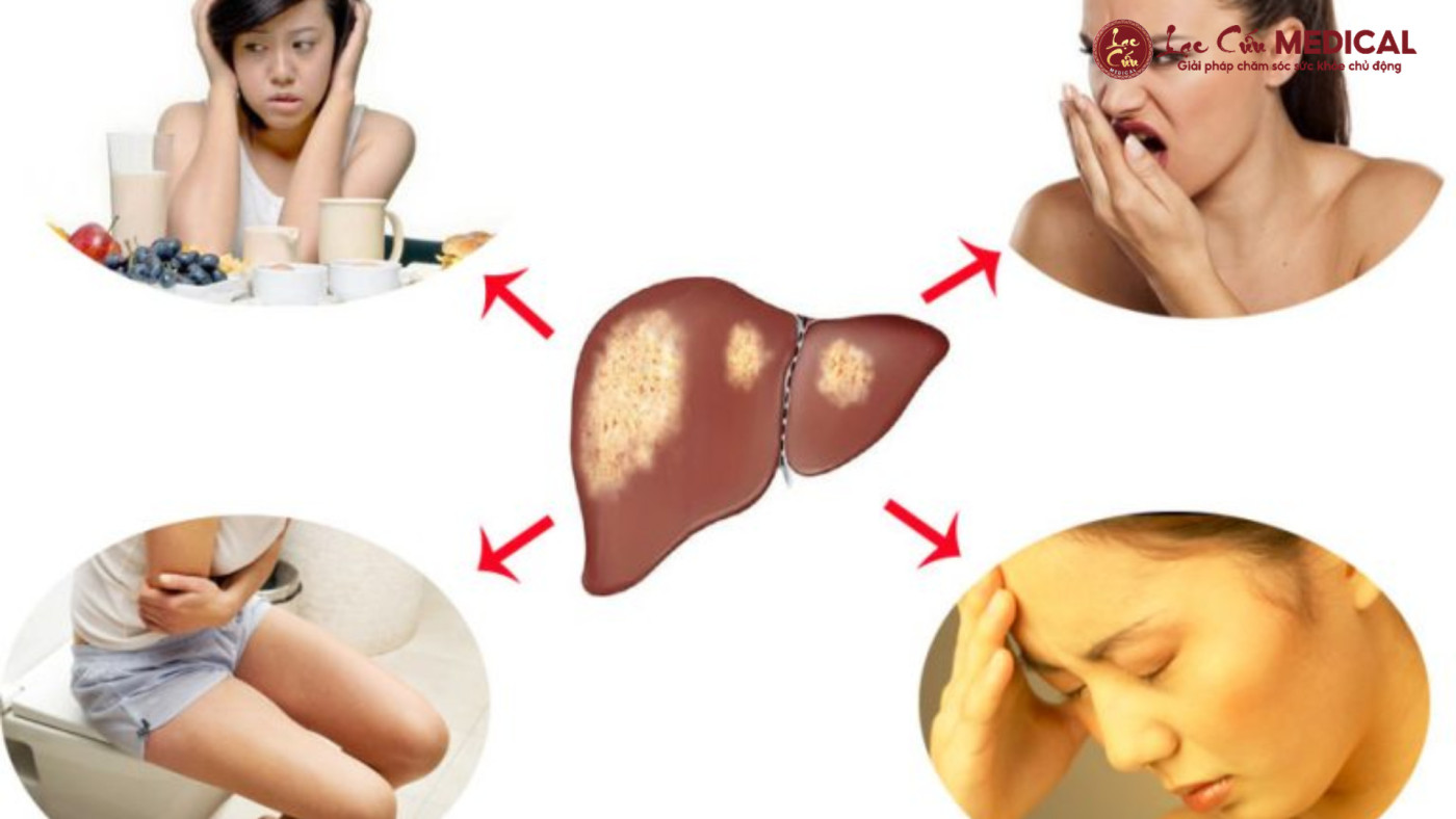 Dấu Hiệu Cho Thấy Làn Da Đang _Cầu Cứu_ Vì Gan Suy Yếu