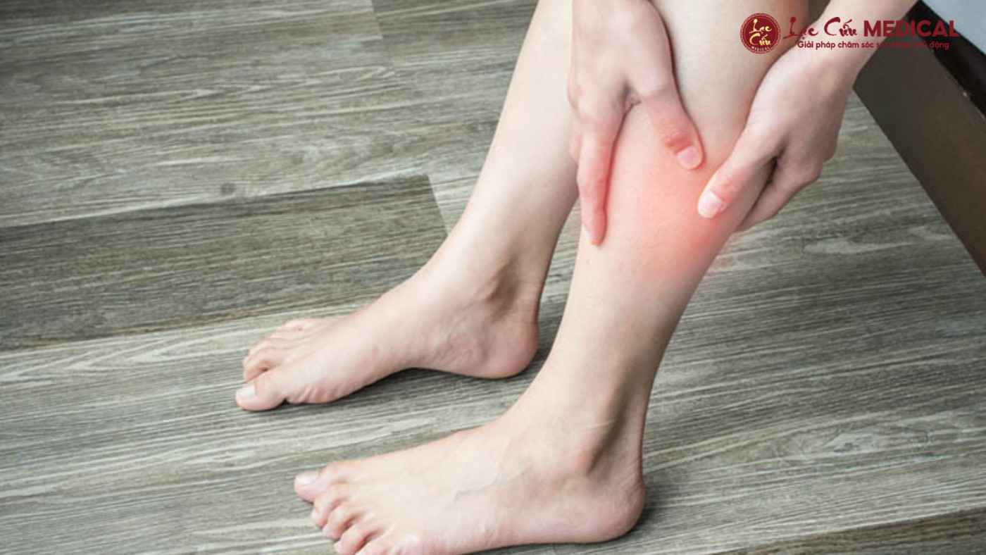 Khi Bắp Chân _Biểu Tình__ Không Chỉ Là Đau Mỏi Thông Thường