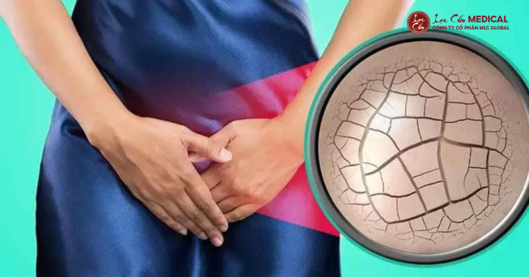 Khô Hạn_ Khi Nguồn Nước Nội Sinh Bị Cạn Kiệt