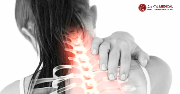 Cổ Đau Âm Ỉ_ Không Chỉ Là Cảm Giác Khó Chịu Nhất Thời