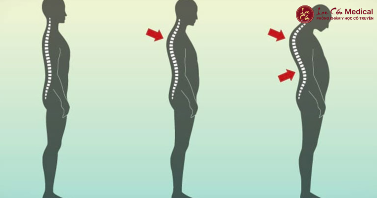 Hệ Quả Âm Thầm Nhưng _Tàn Phá_ Thể Trạng