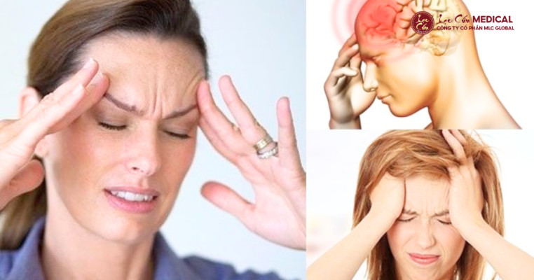 Nỗi Ám Ảnh Mang Tên Đau Nửa Đầu Ở Dân Văn Phòng Và Người Trẻ