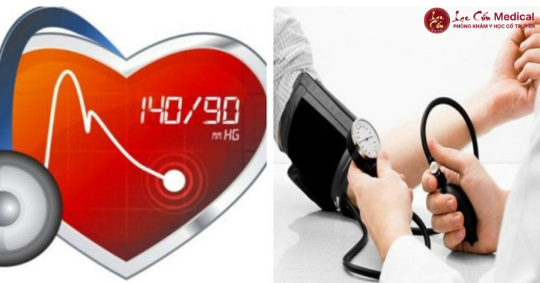 Vì Sao Tăng Huyết Áp Được Coi Là _Kẻ Âm Thầm_ Đe Dọa Đột Quỵ