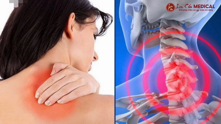 Tại Sao Sau Tết Cơ Thể Lại _Biểu Đình_ Bằng Những Cơn Đau