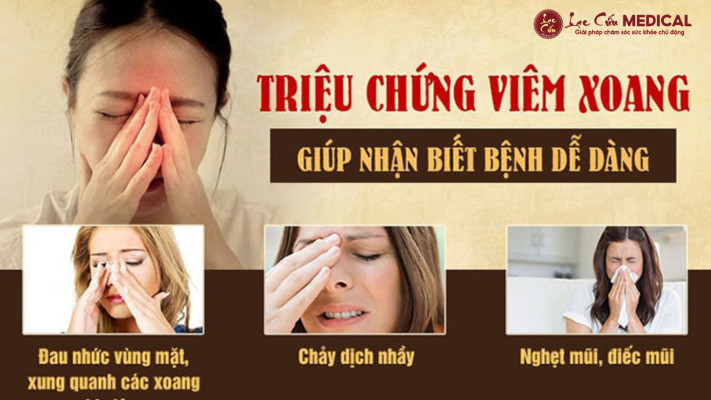 Viêm Xoang – _Nỗi Ám Ảnh_ Không Chỉ Của Riêng Ai